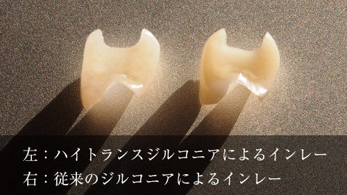 ハイトランスジルコニア